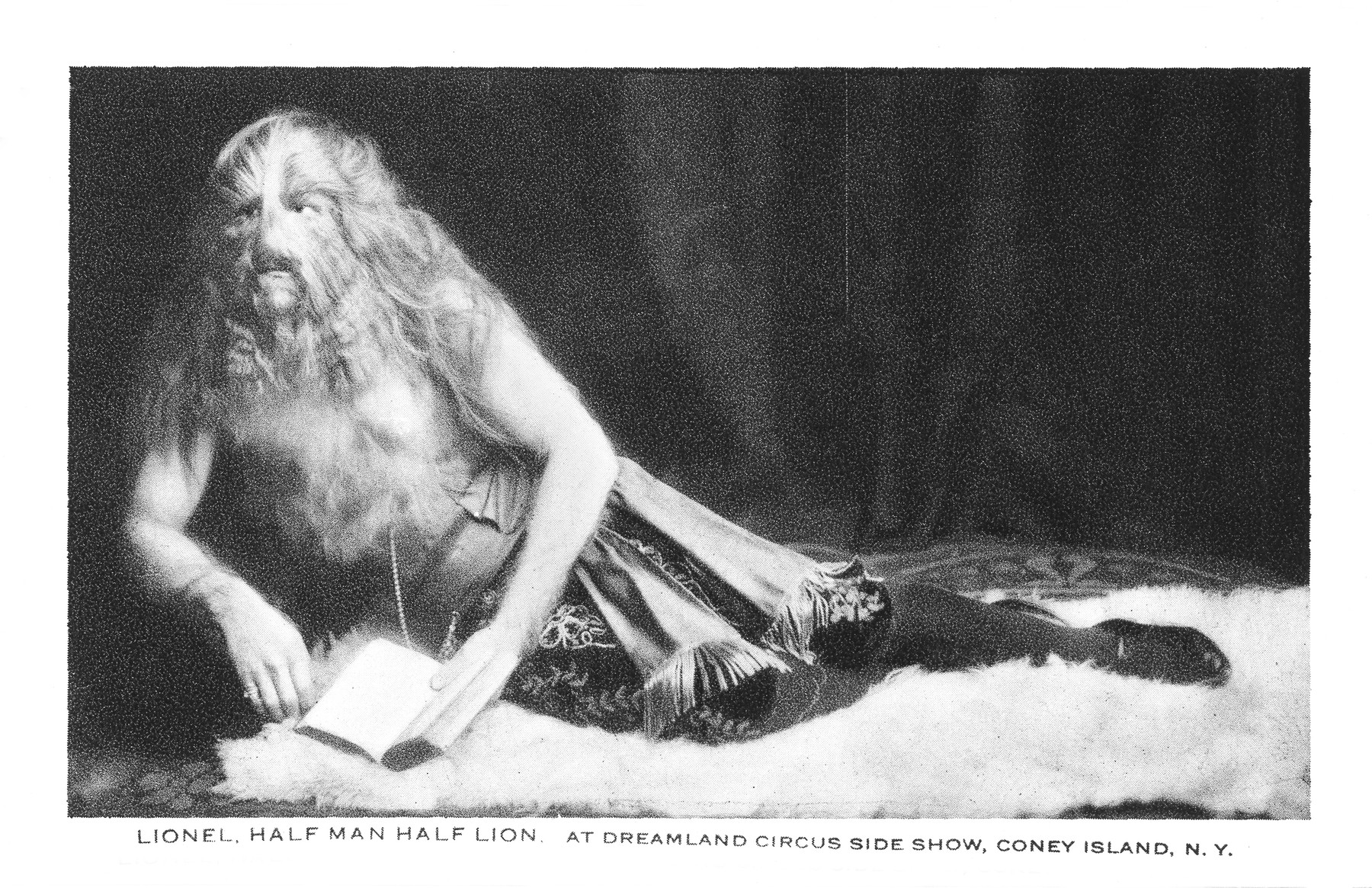 Oroszlánfejjel született egy kisbaba, egész életét félig ember félig oroszlánként élte le